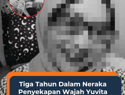 Tiga Tahun dalam Neraka Penyekapan Wajah Yuvita Hancur, Kekasihnya Kabur Saat Korban Dirujuk ke RSHS Kota Bandung